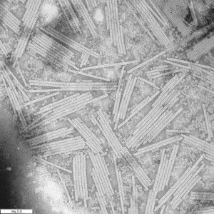 qué hacer con enfermedades por virus en plantas: el virus del mosaico del tomate en un microscopio electrónico
